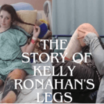 Kelly Ronahan's Legs: A Heartbreaking Story of Overcoming Adversity