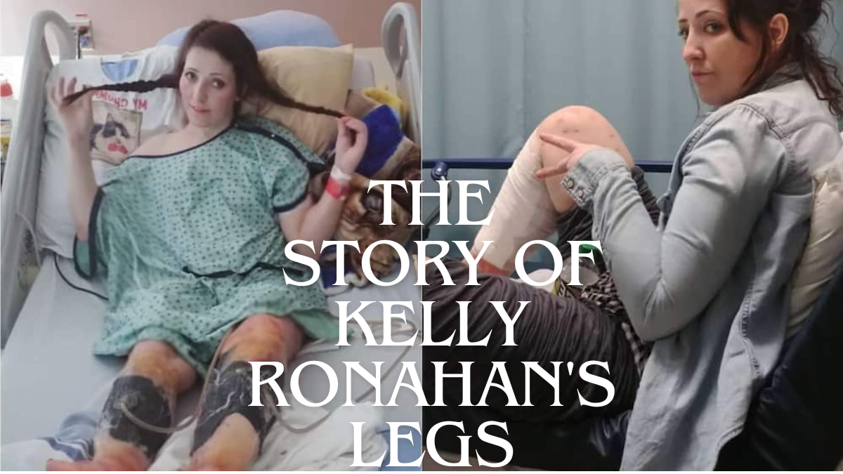 Kelly Ronahan's Legs: A Heartbreaking Story of Overcoming Adversity