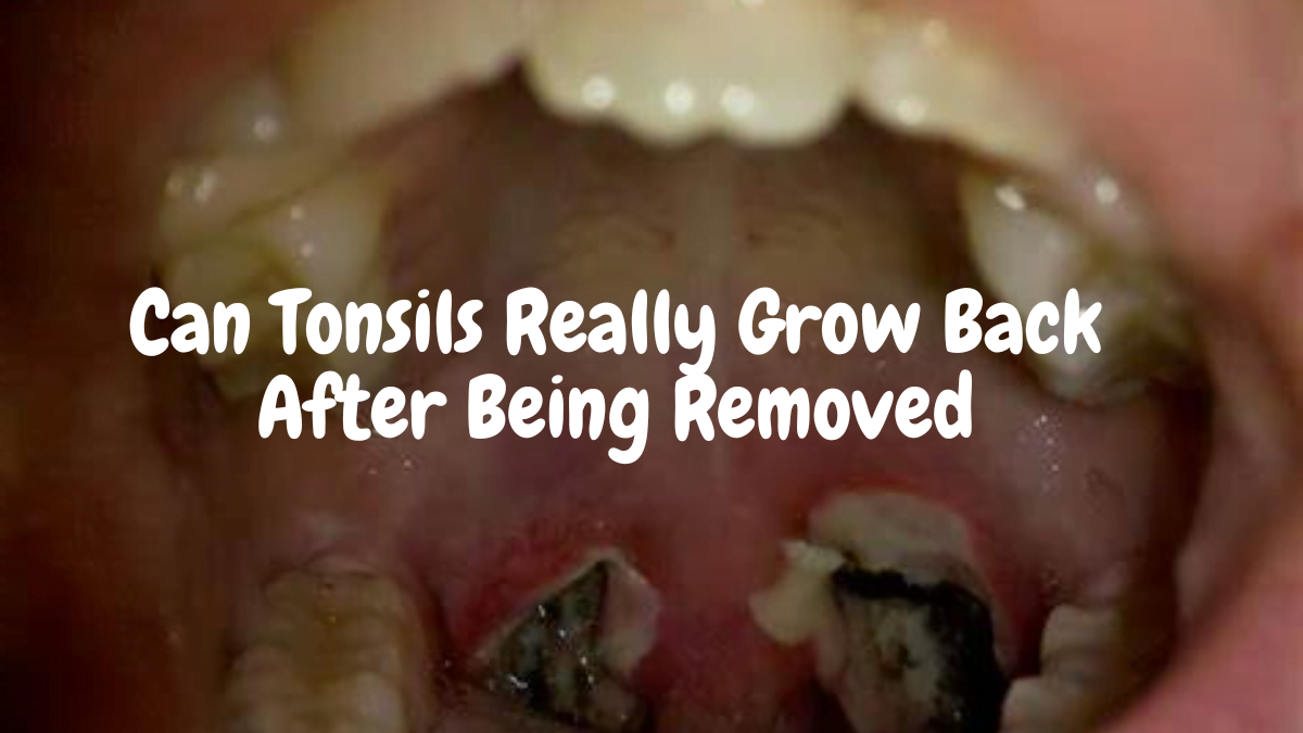 Best Guide Can Tonsils Really Grow Back After Being Removed? - Tymoff Revealed 2024